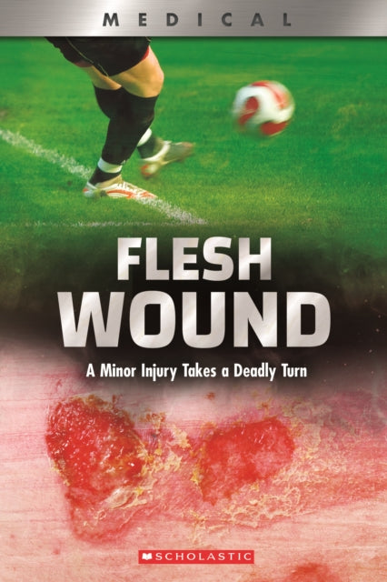 Flesh Wound: A Minor Injury Takes a Deadly Turn (XBooks)