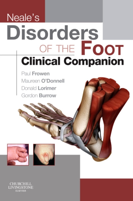 Neale`S Disorders of the Foot Clinical Companion