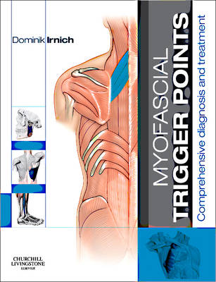 Myofascial Trigger Points: Comprehensive Diagnosis and Treatment