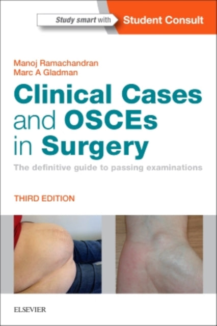 Clinical Cases and OSCEs in Surgery: The definitive guide to passing examinations