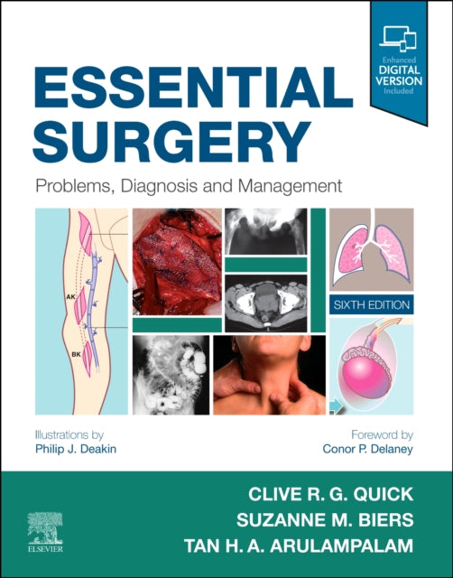 Essential Surgery - Problems, Diagnosis and Management