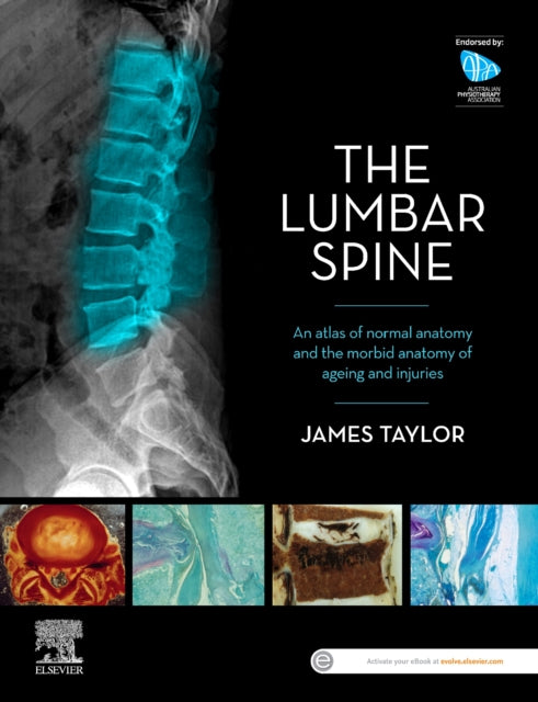 The Lumbar Spine - An Atlas of Normal Anatomy and the Morbid Anatomy of Ageing and Injury
