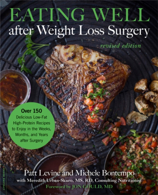 Eating Well after Weight Loss Surgery (Revised)