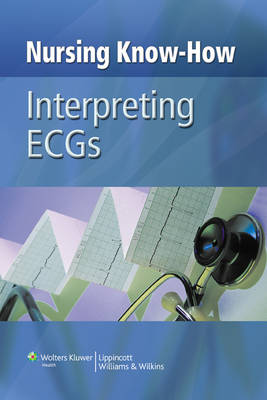 NURSING KNOW-HOW:INTERPRETING ECGS