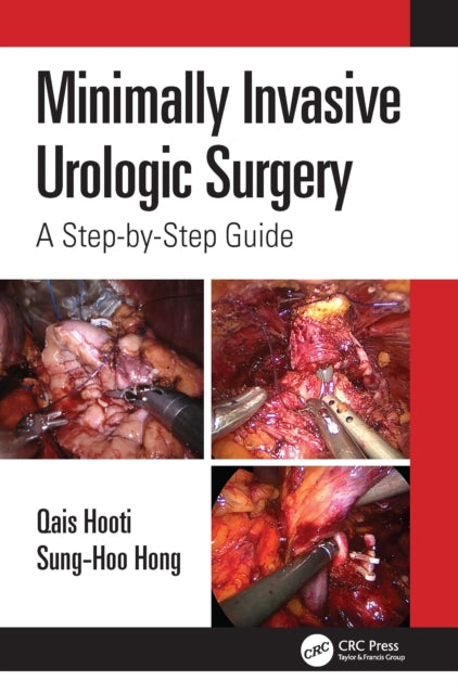 Minimally Invasive Urologic Surgery - A Step-by-Step Guide