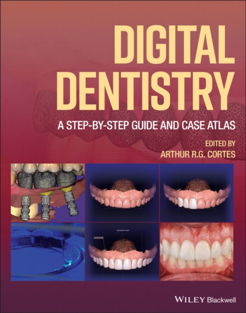 Digital Dentistry: A Step-by-Step Guide and Case A tlas