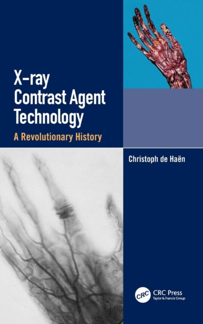 X-ray Contrast Agent Technology - A Revolutionary History