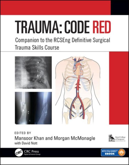 Trauma: Code Red - Companion to the RCSEng Definitive Surgical Trauma Skills Course