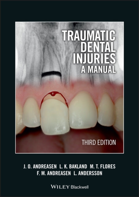 Traumatic Dental Injuries - a Manual 3E