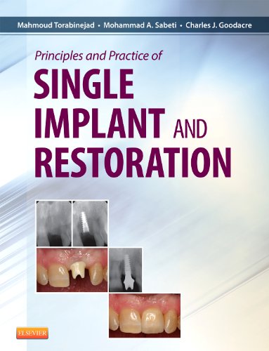 Principles and Practice of Single Implant and Restoration