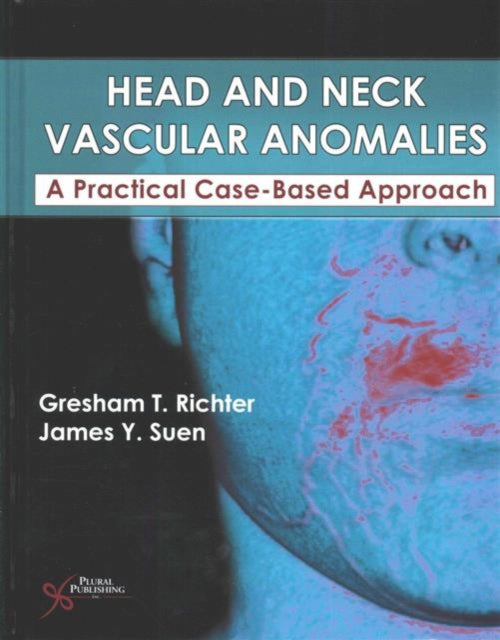 Head and Neck Vascular Anomalies