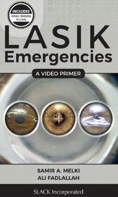 LASIK Emergencies: A Video Primer