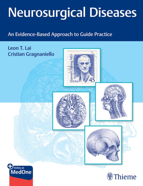 Neurosurgical Diseases - An Evidence-Based Approach to Guide Practice