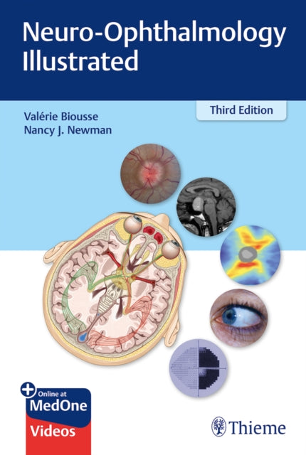 NEURO-OPHTHALMOLOGY ILLUSTRATED 3RD ED