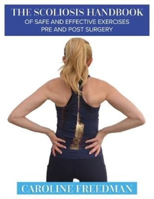 Scoliosis Handbook of Safe and Effective Exercises Pre and Post Surgery