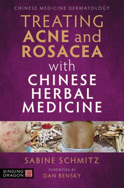 Treating Acne and Rosacea with Chinese Herbal Medicine