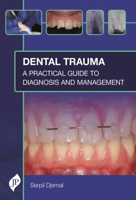 Dental Trauma