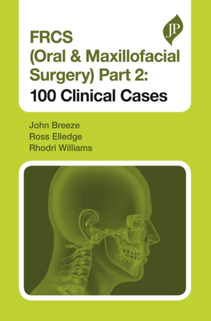 FRCS (Oral & Maxillofacial Surgery) Part 2: 100 Clinical Cases