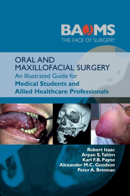 ORAL AND MAXILLOFACIAL SURGERY - An Illustrated Guide for Medical Students and Allied Healthcare Professionals