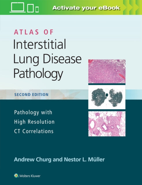 ATLAS OF INTERSTITIAL LUNG DISEASE PATHOLOGY