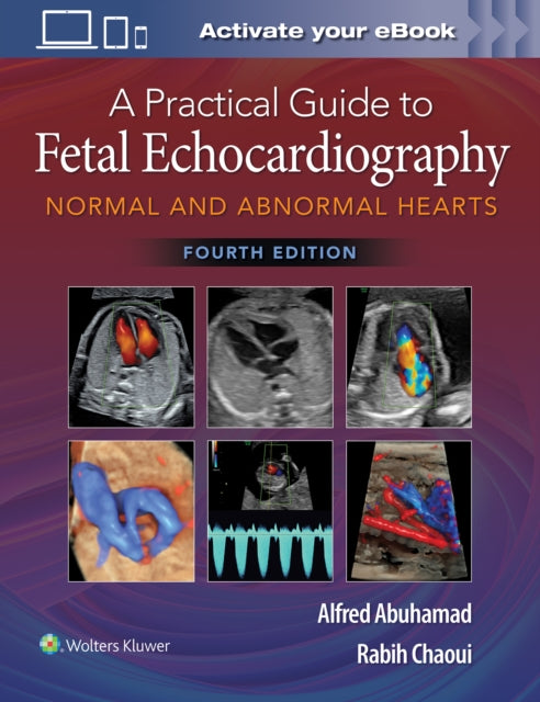 Practical Guide to Fetal Echocardiography