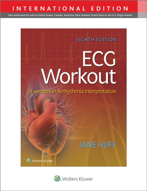 ECG Workout : Exercises in Arrythmia Interpretation