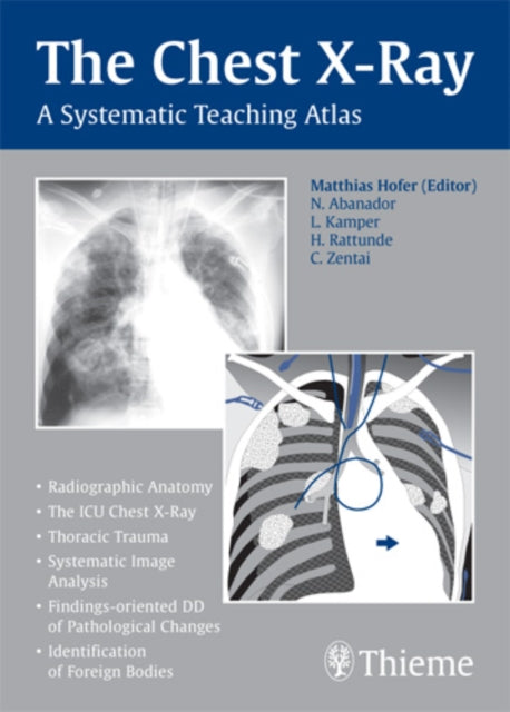 Chest X-ray Trainer: A Systematic Teaching Atlas