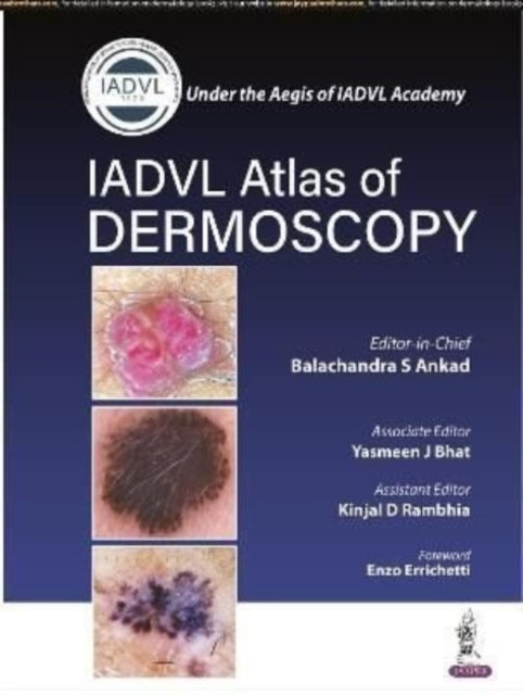 Atlas of Dermoscopy